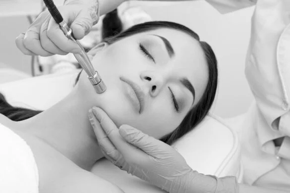 Microdermabrasion-Wall-Township-NJ